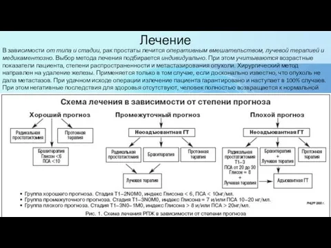 Лечение В зависимости от типа и стадии, рак простаты лечится оперативным