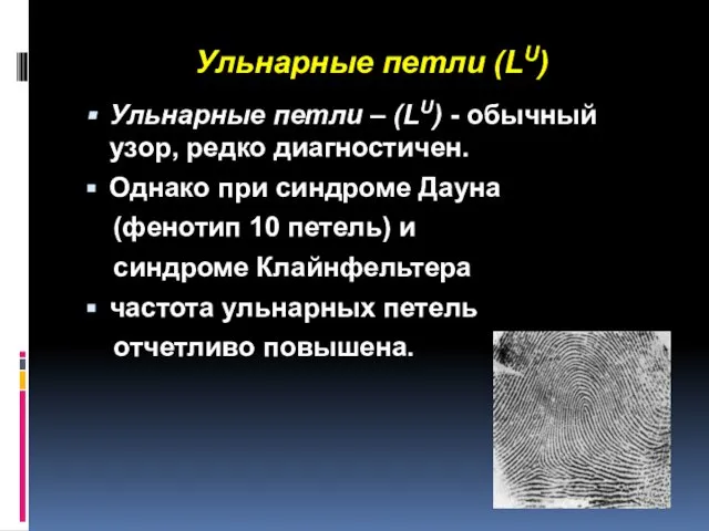 Ульнарные петли (LU) Ульнарные петли – (LU) - обычный узор, редко