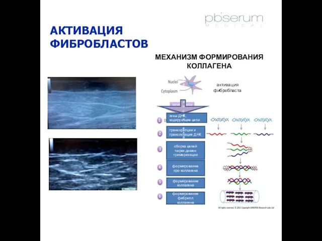 АКТИВАЦИЯ ФИБРОБЛАСТОВ гены ДНК, кодирующие цепи транскрипции и транслокация ДНК сборка