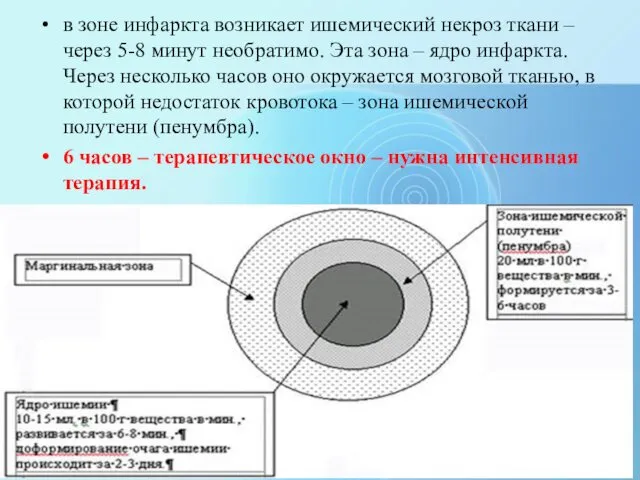 в зоне инфаркта возникает ишемический некроз ткани – через 5-8 минут