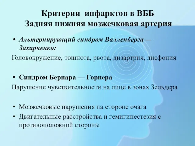 Критерии инфарктов в ВББ Задняя нижняя мозжечковая артерия Альтернирующий синдром Валленберга