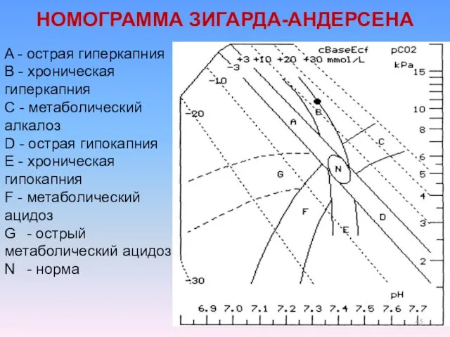 НОМОГРАММА ЗИГАРДА-АНДЕРСЕНА A - острая гиперкапния В - хроническая гиперкапния C