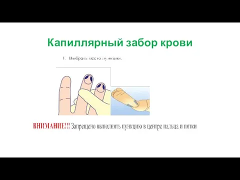 Капиллярный забор крови