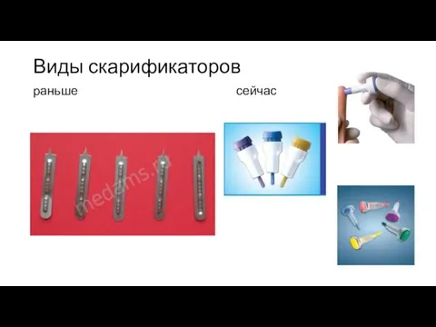 Виды скарификаторов раньше сейчас