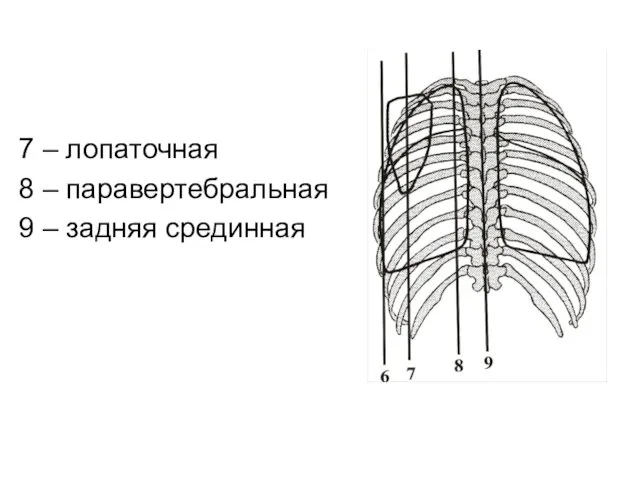 7 – лопаточная 8 – паравертебральная 9 – задняя срединная