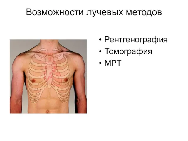 Возможности лучевых методов Рентгенография Томография МРТ