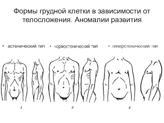 Формы грудной клетки в зависимости от телосложения. Аномалии развития астенический тип