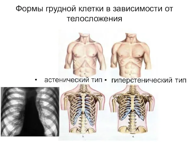 Формы грудной клетки в зависимости от телосложения