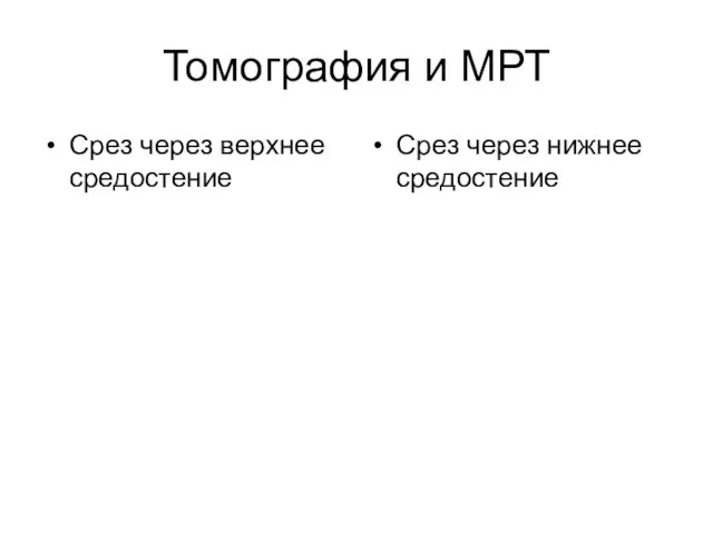 Томография и МРТ Срез через верхнее средостение Срез через нижнее средостение