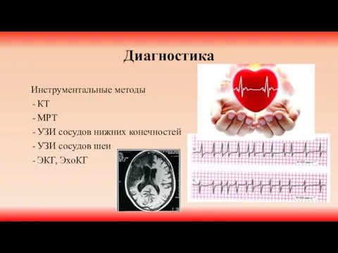 Диагностика Инструментальные методы КТ МРТ УЗИ сосудов нижних конечностей УЗИ сосудов шеи ЭКГ, ЭхоКГ