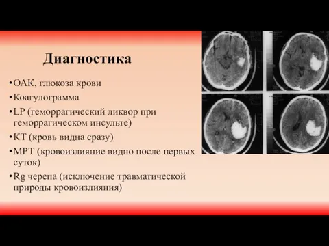 Диагностика ОАК, глюкоза крови Коагулограмма LP (геморрагический ликвор при геморрагическом инсульте)