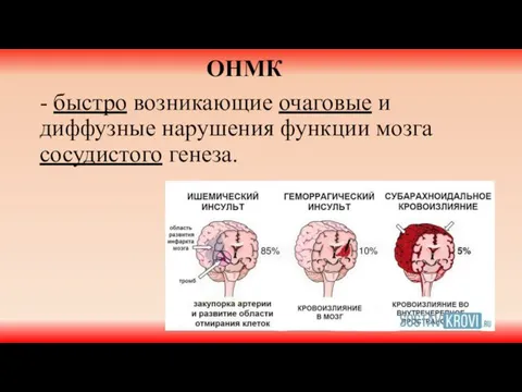 ОНМК - быстро возникающие очаговые и диффузные нарушения функции мозга сосудистого генеза.