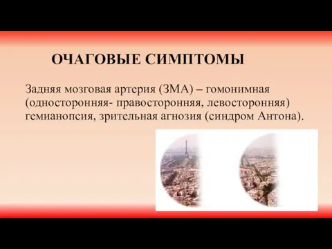 ОЧАГОВЫЕ СИМПТОМЫ Задняя мозговая артерия (ЗМА) – гомонимная (односторонняя- правосторонняя, левосторонняя) гемианопсия, зрительная агнозия (синдром Антона).