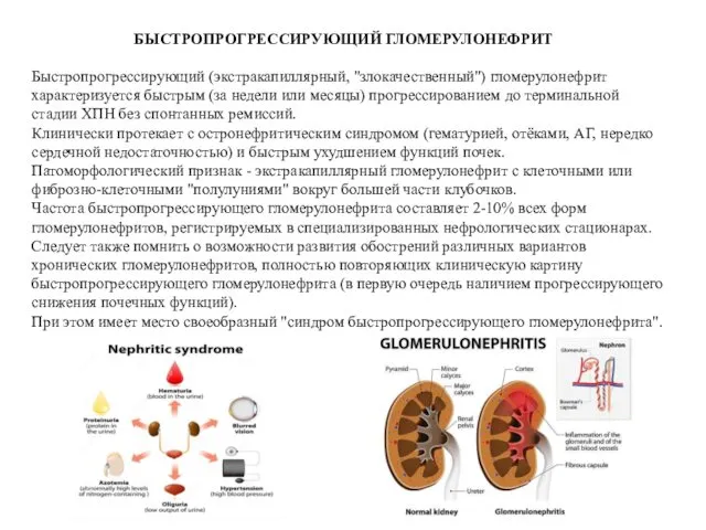 БЫСТРОПРОГРЕССИРУЮЩИЙ ГЛОМЕРУЛОНЕФРИТ Быстропрогрессирующий (экстракапиллярный, "злокачественный") гломерулонефрит характеризуется быстрым (за недели или