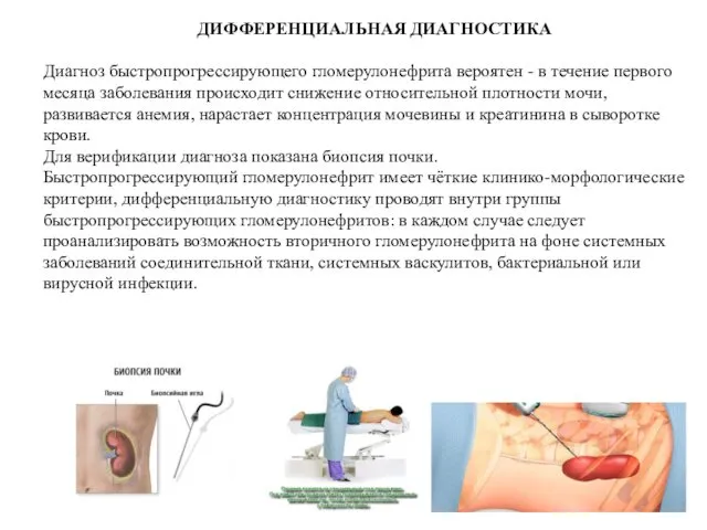 ДИФФЕРЕНЦИАЛЬНАЯ ДИАГНОСТИКА Диагноз быстропрогрессирующего гломерулонефрита вероятен - в течение первого месяца