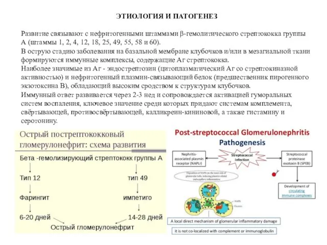 ЭТИОЛОГИЯ И ПАТОГЕНЕЗ Развитие связывают с нефритогенными штаммами β-гемолитического стрептококка группы