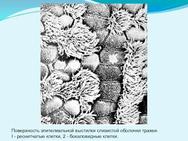 Поверхность эпителиальной выстилки слизистой оболочки трахеи. I - реснитчатые клетки, 2 - бокаловидные клетки.
