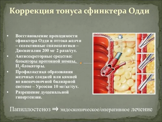 Коррекция тонуса сфинктера Одди Папиллостеноз ⇒ эндоскопическое/оперативное лечение Восстановление проходимости сфинктера