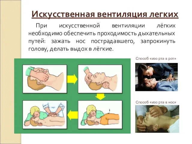 При искусственной вентиляции лёгких необходимо обеспечить проходимость дыхательных путей: зажать нос