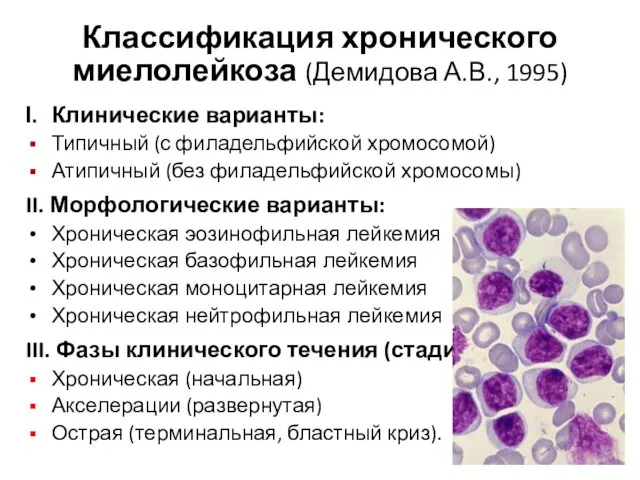 Классификация хронического миелолейкоза (Демидова А.В., 1995) Клинические варианты: Типичный (с филадельфийской