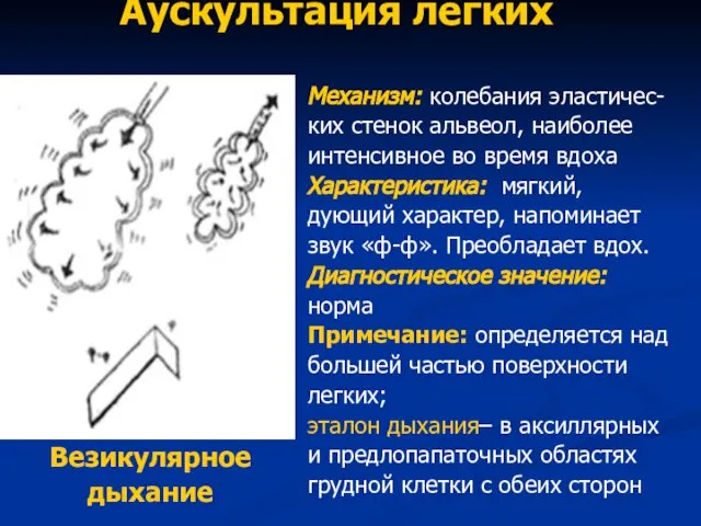 Аускультация легких Везикулярное дыхание Механизм: колебания эластичес- ких стенок альвеол, наиболее