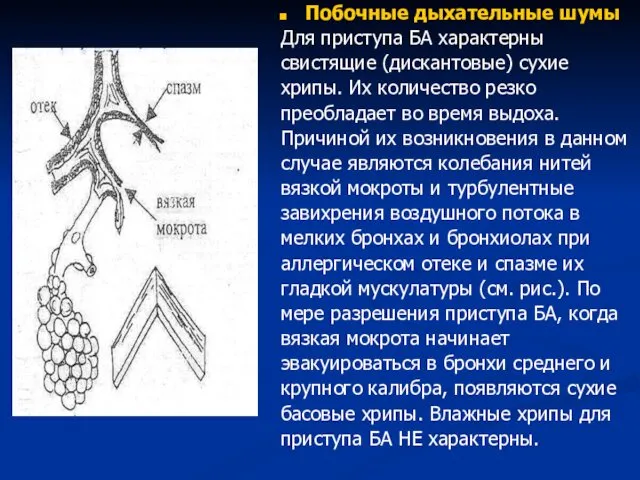 Побочные дыхательные шумы Для приступа БА характерны свистящие (дискантовые) сухие хрипы.