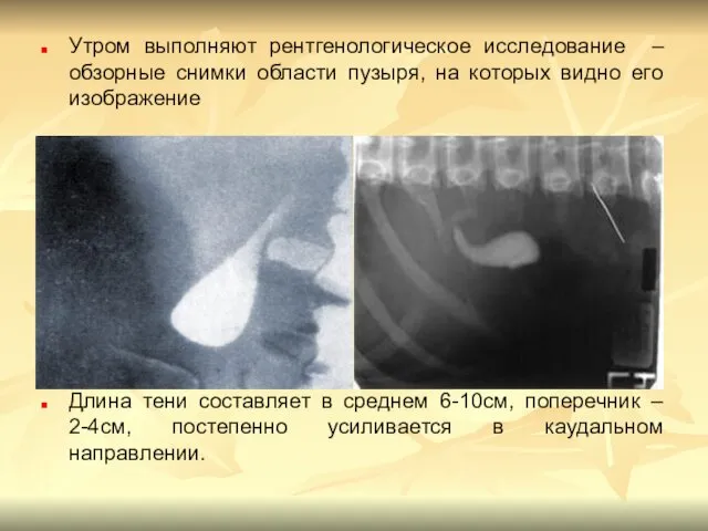 Утром выполняют рентгенологическое исследование – обзорные снимки области пузыря, на которых