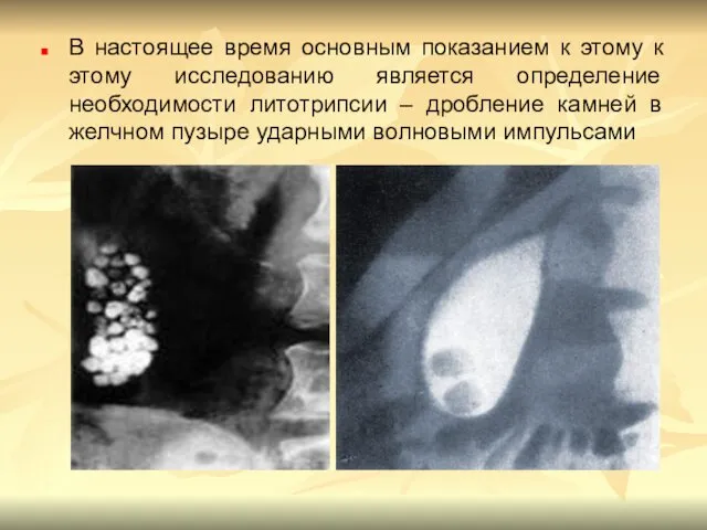 В настоящее время основным показанием к этому к этому исследованию является