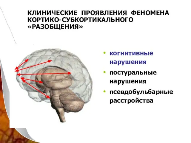 КЛИНИЧЕСКИЕ ПРОЯВЛЕНИЯ ФЕНОМЕНА КОРТИКО-СУБКОРТИКАЛЬНОГО «РАЗОБЩЕНИЯ» когнитивные нарушения постуральные нарушения псевдобульбарные расстройства