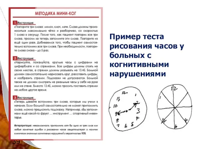 Пример теста рисования часов у больных с когнитивными нарушениями