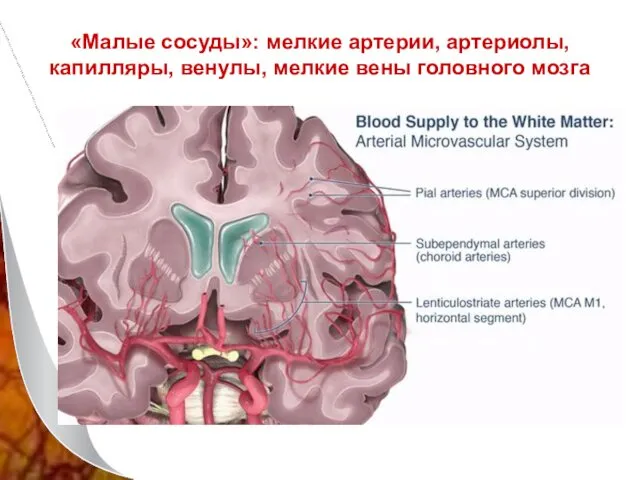 «Малые сосуды»: мелкие артерии, артериолы, капилляры, венулы, мелкие вены головного мозга