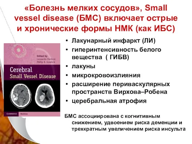 «Болезнь мелких сосудов», Small vessel disease (БМС) включает острые и хронические