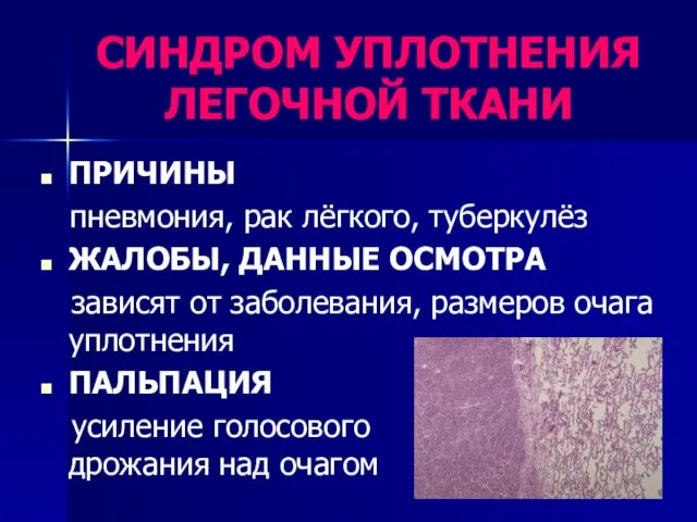 СИНДРОМ УПЛОТНЕНИЯ ЛЕГОЧНОЙ ТКАНИ ПРИЧИНЫ пневмония, рак лёгкого, туберкулёз ЖАЛОБЫ, ДАННЫЕ