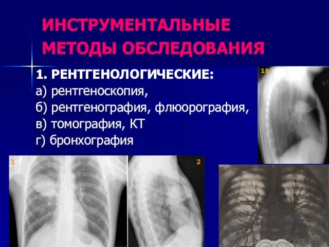 ИНСТРУМЕНТАЛЬНЫЕ МЕТОДЫ ОБСЛЕДОВАНИЯ 1. РЕНТГЕНОЛОГИЧЕСКИЕ: а) рентгеноскопия, б) рентгенография, флюорография, в) томография, КТ г) бронхография