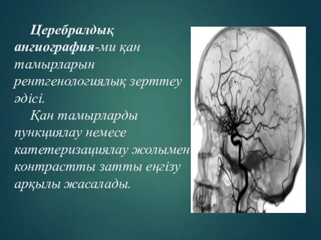 Церебралдық ангиография-ми қан тамырларын рентгенологиялық зерттеу әдісі. Қан тамырларды пункциялау немесе