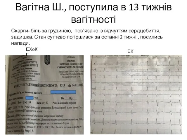 Вагітна Ш., поступила в 13 тижнів вагітності Скарги- біль за грудиною,