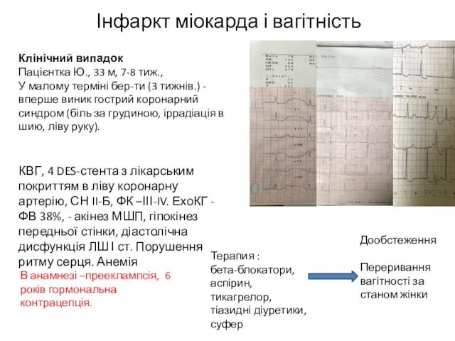 Інфаркт міокарда і вагітність Клінічний випадок Пацієнтка Ю., 33 м, 7-8