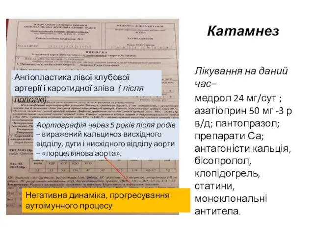 КаК Ангіопластика лівої клубової артерії і каротидної зліва ( після пологів).