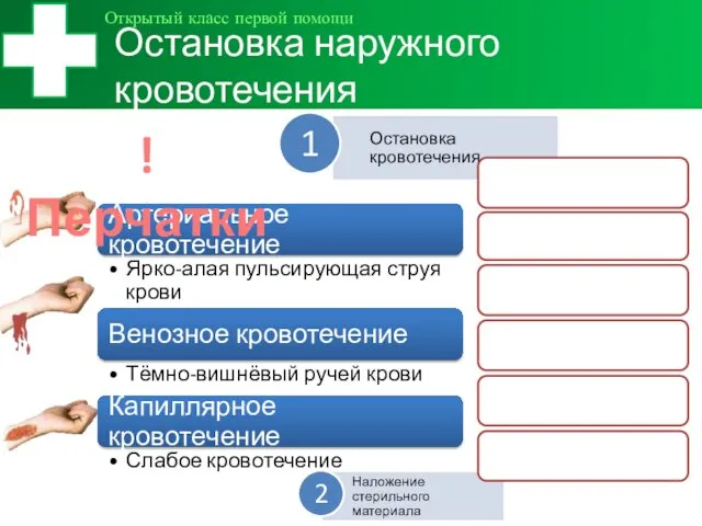 Остановка наружного кровотечения Открытый класс первой помощи ! Перчатки