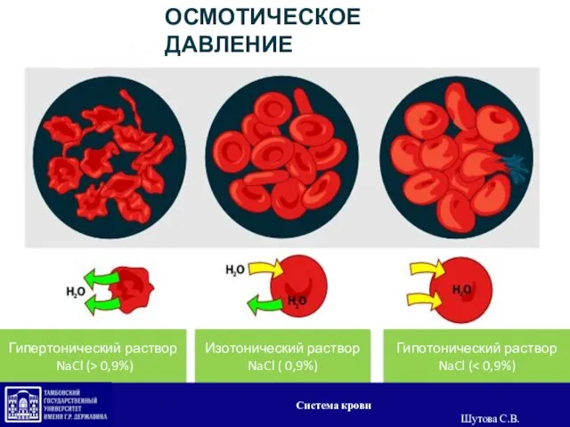 Гипертонический раствор NaCl (> 0,9%) Изотонический раствор NaCl ( 0,9%) Гипотонический