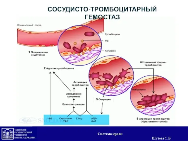 СОСУДИСТО-ТРОМБОЦИТАРНЫЙ ГЕМОСТАЗ Система крови Шутова С.В.