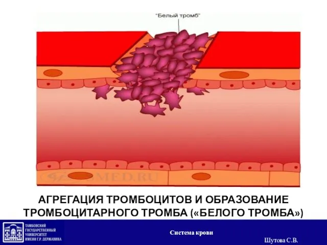 АГРЕГАЦИЯ ТРОМБОЦИТОВ И ОБРАЗОВАНИЕ ТРОМБОЦИТАРНОГО ТРОМБА («БЕЛОГО ТРОМБА») Система крови Шутова С.В.