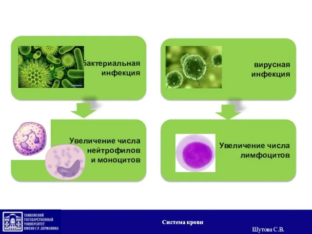 Увеличение числа нейтрофилов и моноцитов бактериальная инфекция вирусная инфекция Увеличение числа лимфоцитов Система крови Шутова С.В.