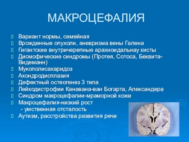 МАКРОЦЕФАЛИЯ Вариант нормы, семейная Врожденные опухоли, аневризма вены Галена Гигантские внутричерепные