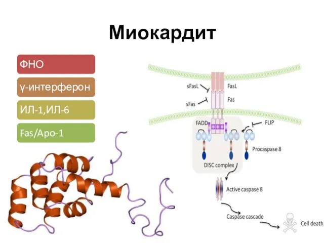 Миокардит