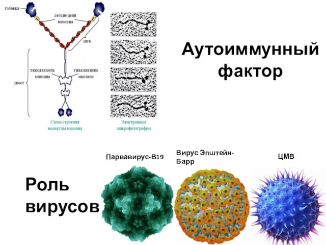 Аутоиммунный фактор Роль вирусов Парвавирус-В19 Вирус Эпштейн-Барр ЦМВ