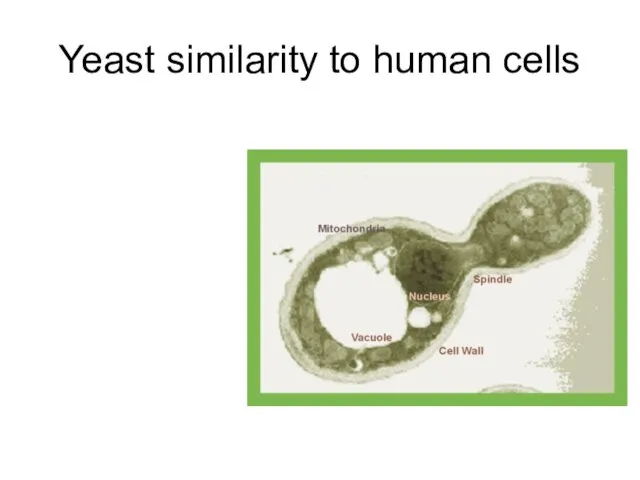 Yeast similarity to human cells