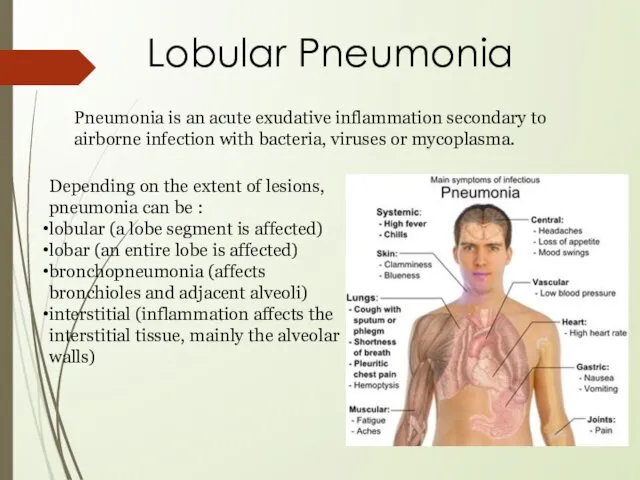 Pneumonia is an acute exudative inflammation secondary to airborne infection with