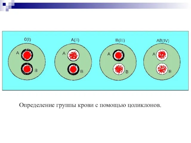 Определение группы крови с помощью цоликлонов.