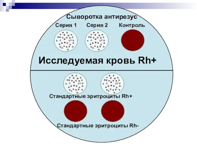 Сыворотка антирезус Серия 1 Серия 2 Контроль Исследуемая кровь Rh+ Стандартные эритроциты Rh+ Стандартные эритроциты Rh-